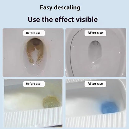 Toilet Cleaner,Toilet Bowl Cleaners Gel Bottle Kit, Automatic Toilets Bowl Cleaning Bottle With Odor Removal,Concentrated All-Purpose Stain Fighter Keep,Deep Clean Agent Tablets Block (1 PCS)