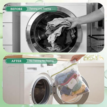 10PCS Mesh Laundry Bags for Delicates, 16"x20" Large Laundry Wash Bags with Zipper, Cute Reusable Laundry Bags for Clothes, Socks and Intimates, Premium Fine Mesh Wash Bag (40x50cm)