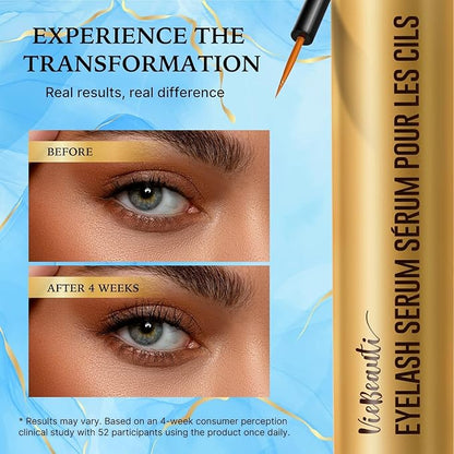 VieBeauti Lash Serum for Eyelash Growth: 5mL Eyelash Growth Serum with Advanced Formula to Boost Longer Fuller and Thicker Looking Lashes - Vegan & Cruelty-Free for Sensitive Eyes 5-Month Supply
